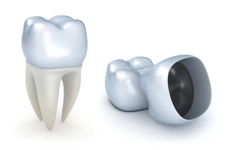 Crow to replace damaged tooth structure at our Antioch Smile Center dental practice